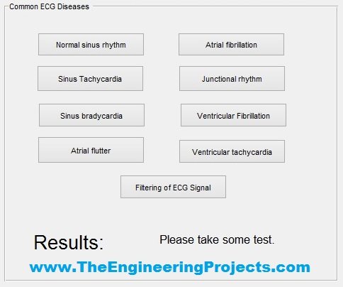 ecg simulator, ecg simulation, ecg features extraction, ecg simulation using matlab, ecg simulation in matlab