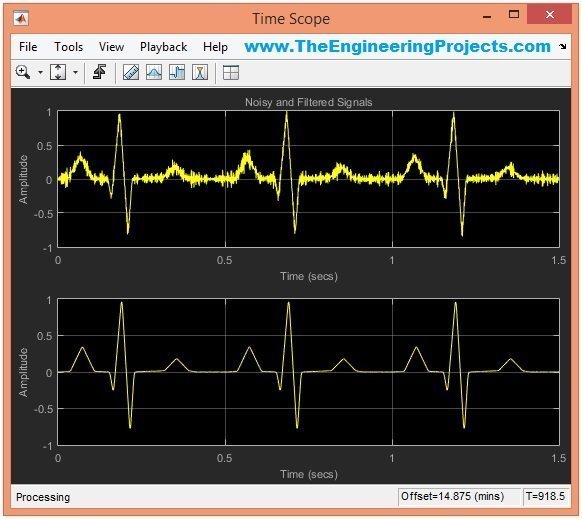 ecg simulator, ecg simulation, ecg features extraction, ecg simulation using matlab, ecg simulation in matlab