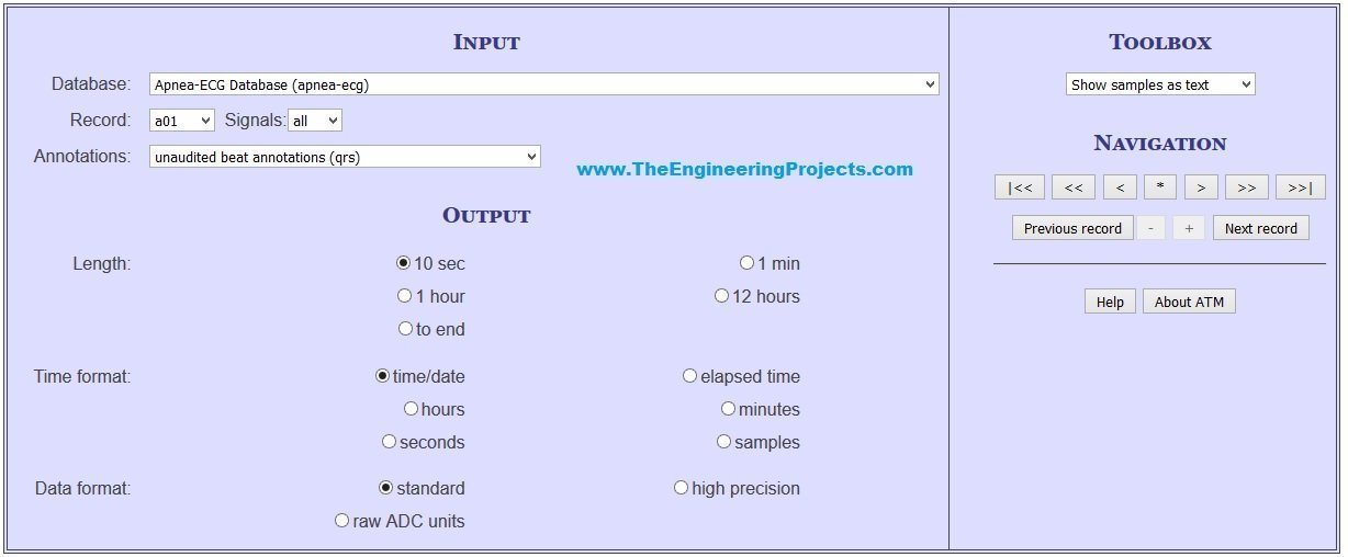 ECG Simulation using MATLAB