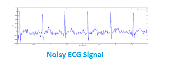 ECG Averaging in MATLAB, ECG Average,average ecg,ecg averaging