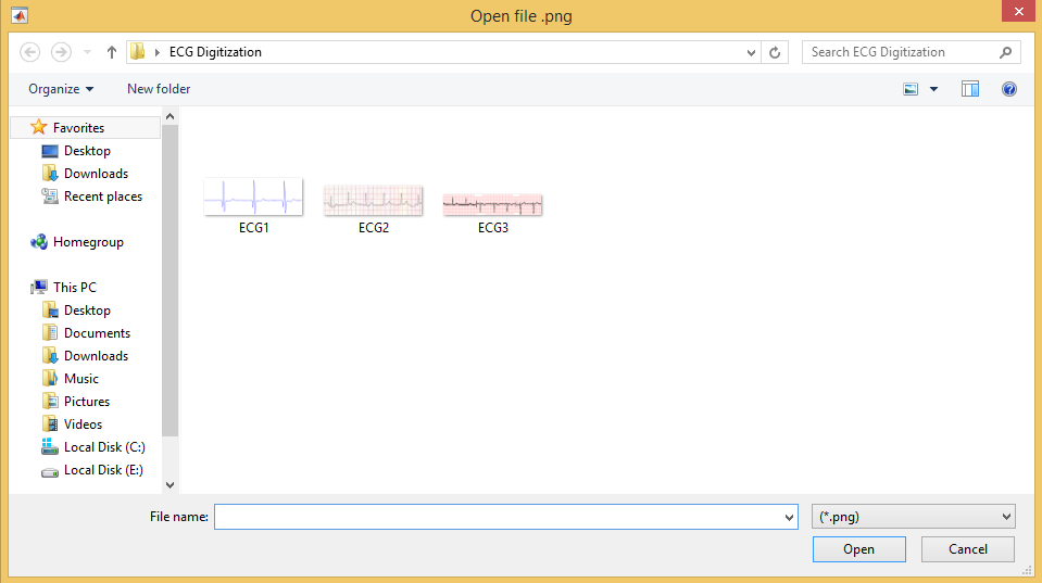 create a hypnogram matlab ecg create a hypnogram matlab ecg
